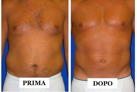Medisculpt Centro Medico Estetico Lugano Medijeunesse